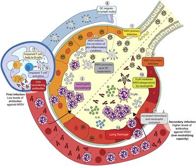 Contribution of Fcγ Receptor-Mediated Immunity to the Pathogenesis Caused by the Human Respiratory Syncytial Virus